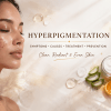 Hyperpigmentation: Symptoms, Causes, Treatment & Prevention